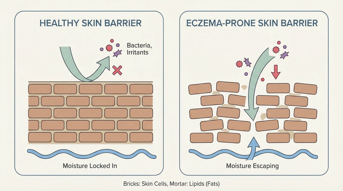 How to Repair the Skin Barrier in Eczema: What Actually Works