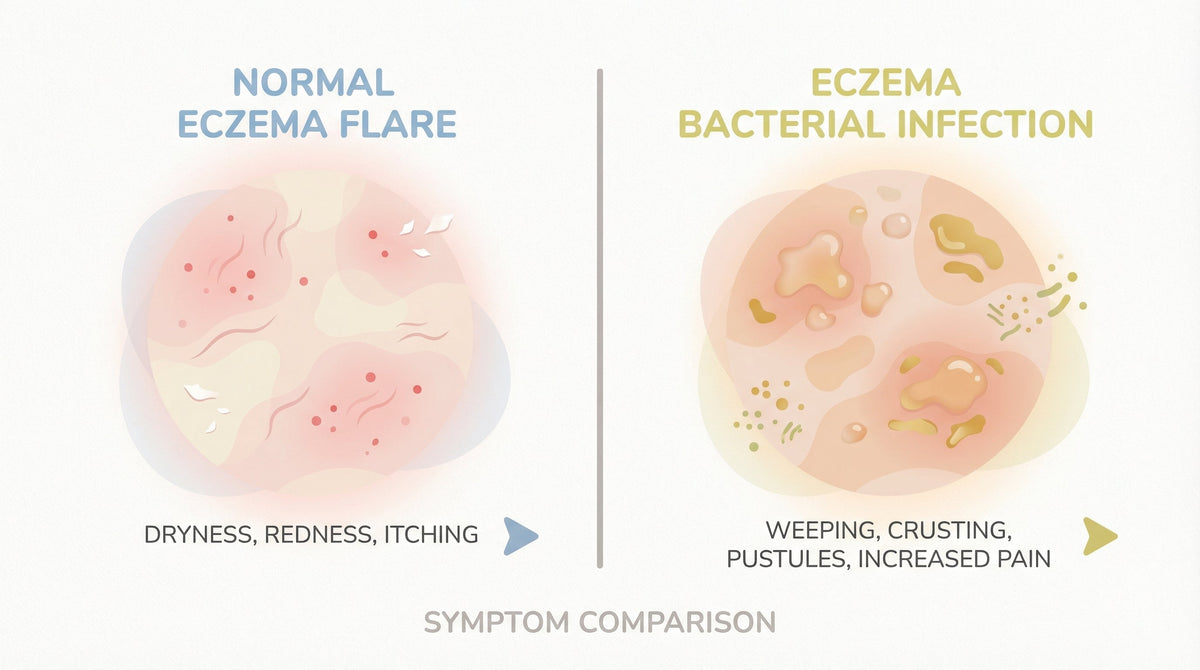 Eczema Bacterial Infection Symptoms: When to Act and What to Look For