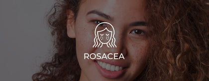 Rosacea