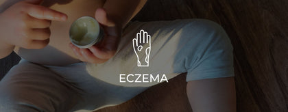 Eczema