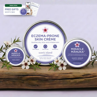 Sven's Island BODY 250g Cream + 55g Balm+ Free Gifts Eczema Soothe & Shield Bundle