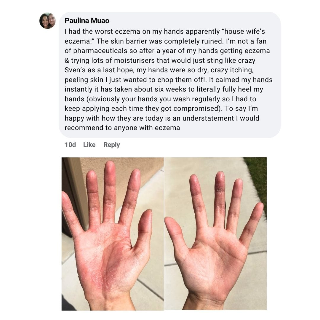 Sven's Island BODY 55g Miracle Manuka - Skin Repair Ointment 55g